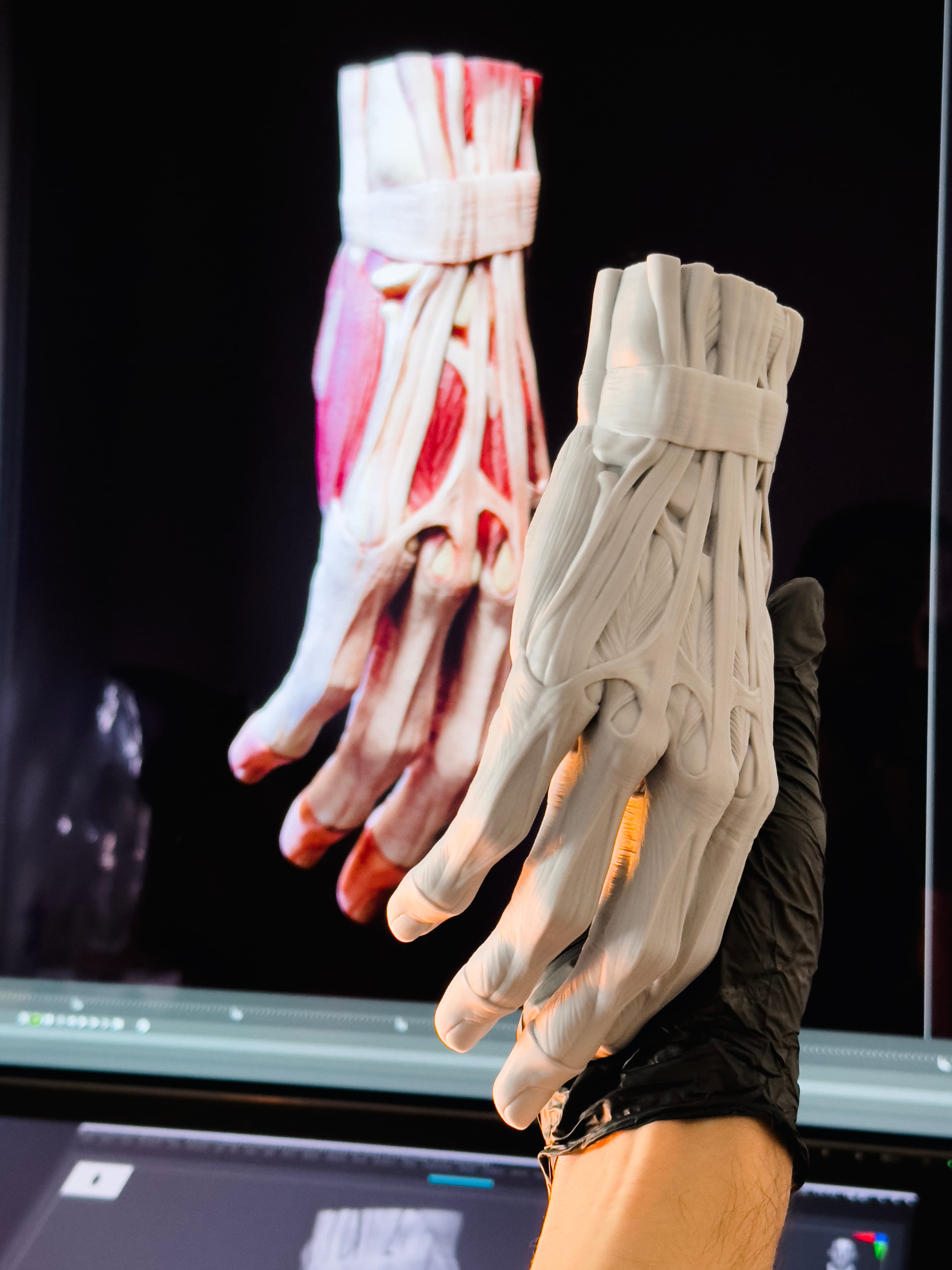 Hand Anatomy
